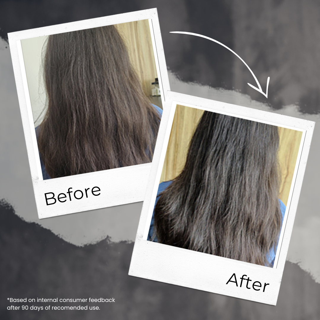 Onion and Keto Shampoo For Hair Fall – 200ml