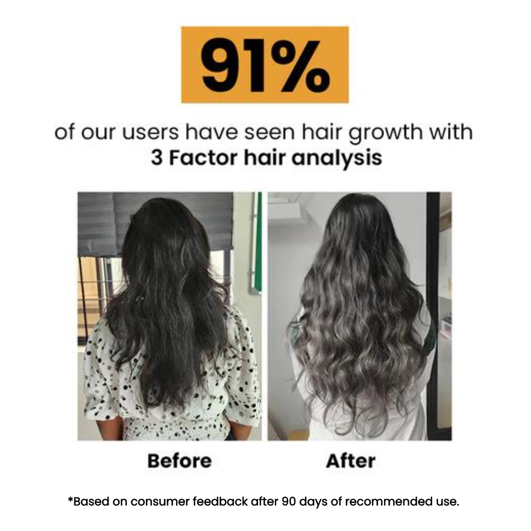 Ayurvedic Hair Oil with Free Heater |  Fights Dandruff, Hair Fall Control, Hair Growth & Shiny Hair | 50ml
