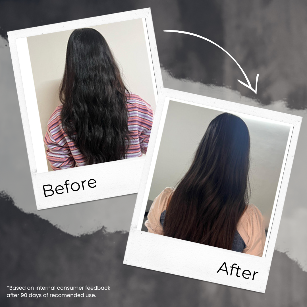 Ayurvedic Hair Oil with Free Heater |  Fights Dandruff, Hair Fall Control, Hair Growth & Shiny Hair | 50ml