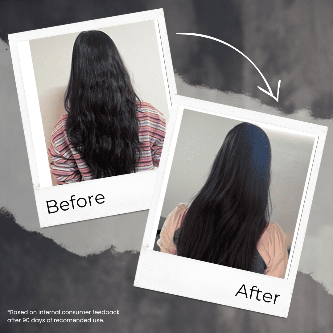 Fermented Rice & Coconut Milk Hair Oil With Free Heater – 110ml| DOTD