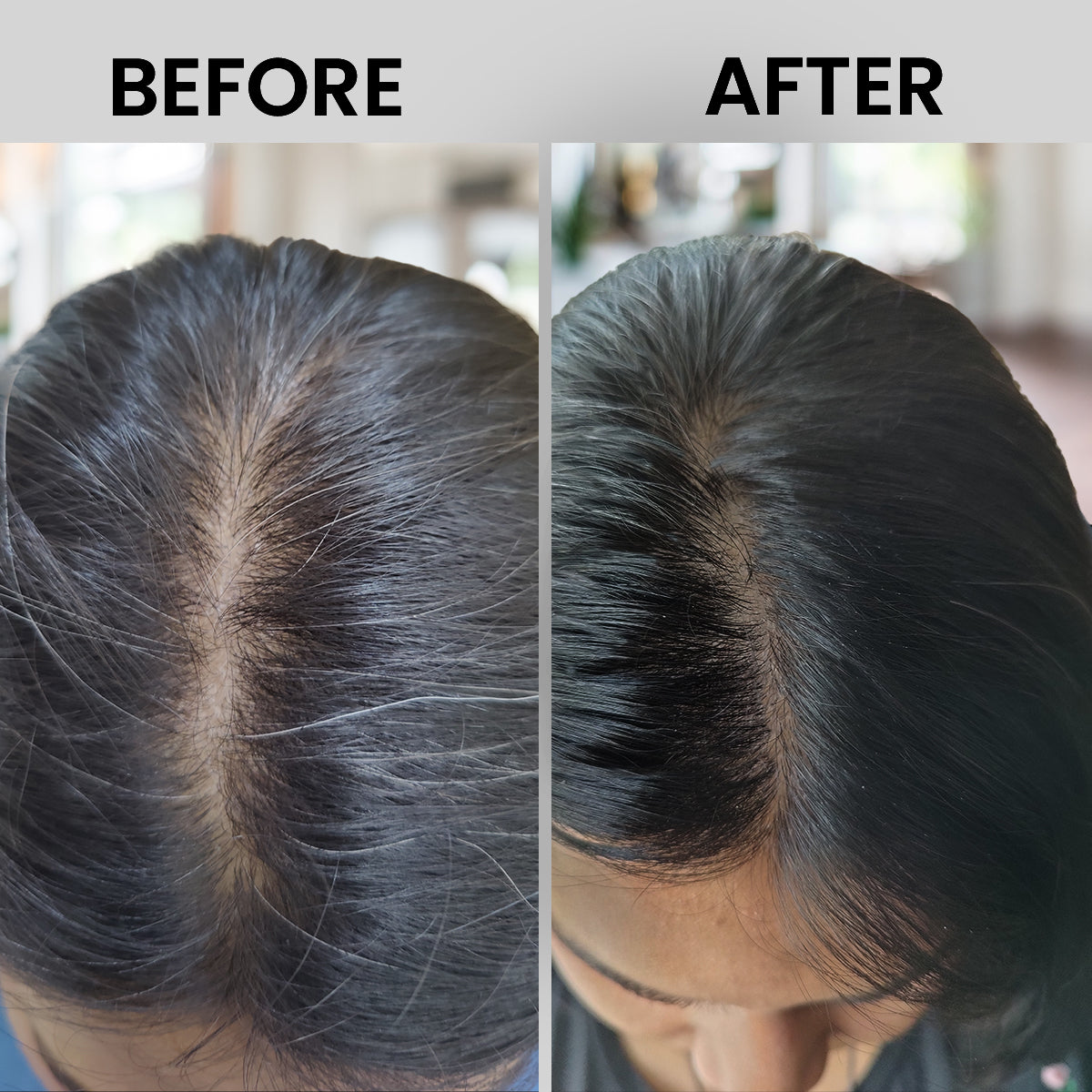 Tru Hair Ayurvedic Hair Oil Refill pack + Biotin Shampoo & Conditioner | For Dandruff, Pre Mature Greying, Hair Growth & Shiny Voluminous Hair