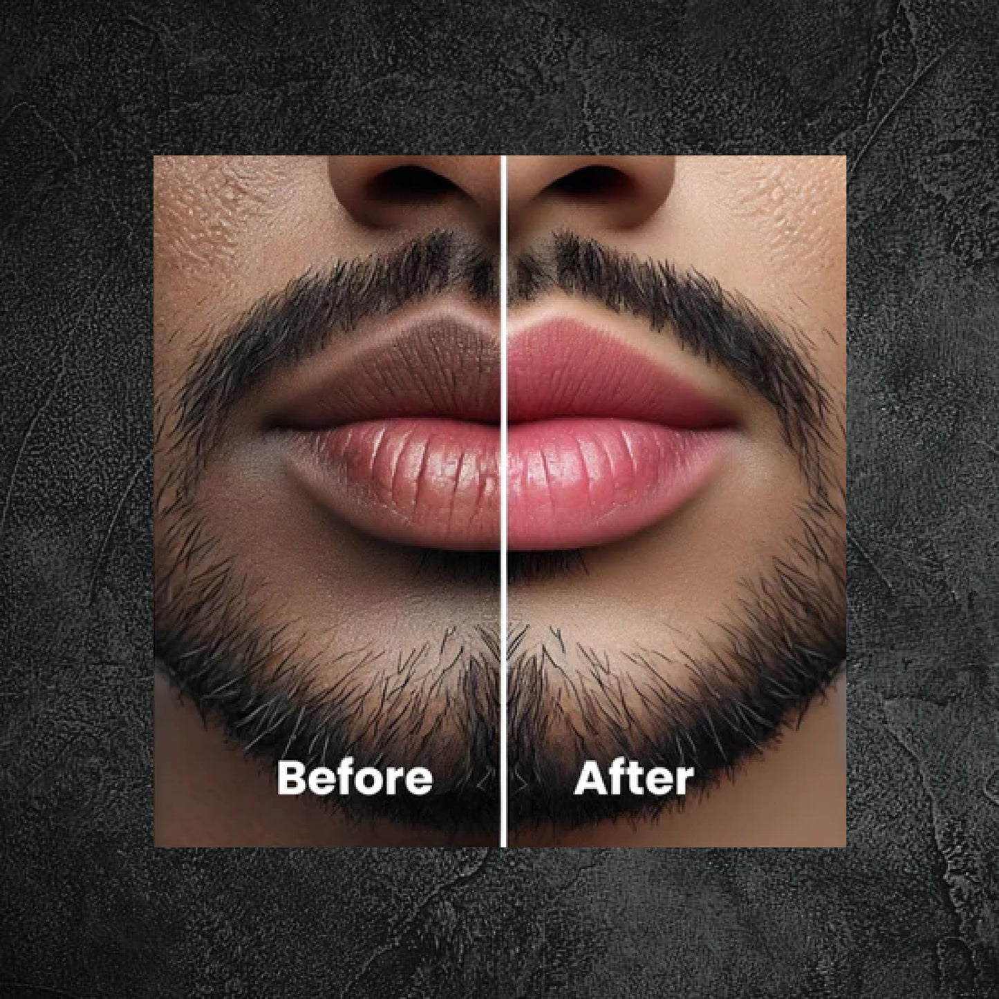 Smoke guard lip balm with spf 15 | 10 gms