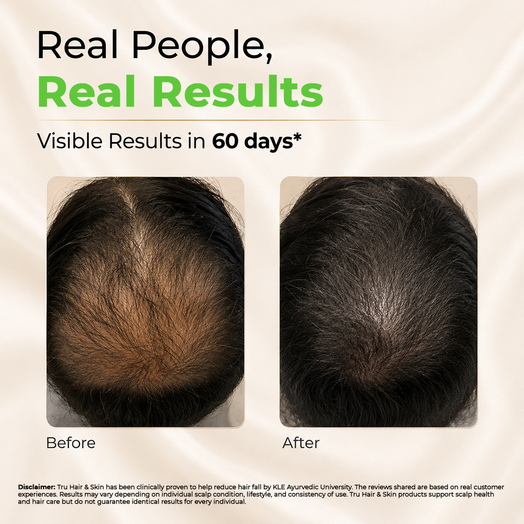 Clinically Proven Ayurvedic Hair Oil + Free Heater with Shampoo | Reduces hair fall