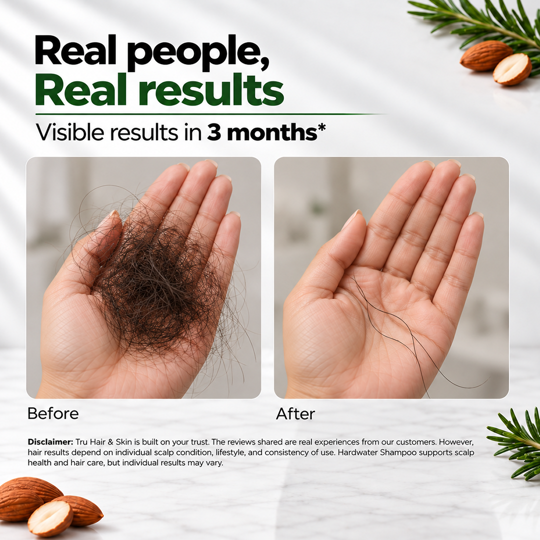 Hard Water Shampoo | For Ultra Soft , Shiny and Dandruff Free Hair
