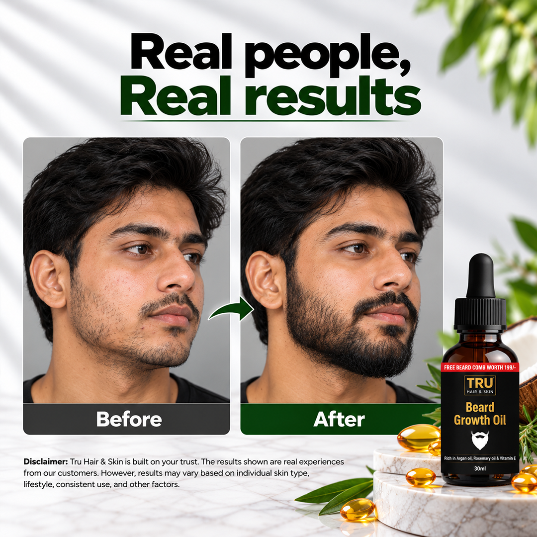 Beard Growth Oil-30ml