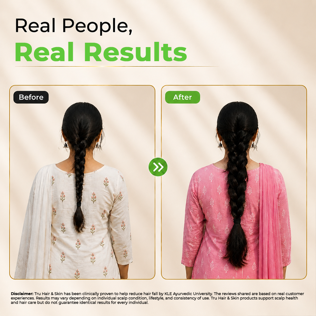 Clinically Proven Ayurvedic Hair Oil + Free Heater with Shampoo | Reduces hair fall