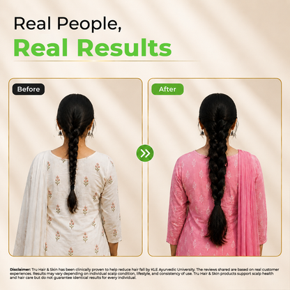 Clinically Proven Ayurvedic Hair Oil + Free Heater with Shampoo | Reduces hair fall