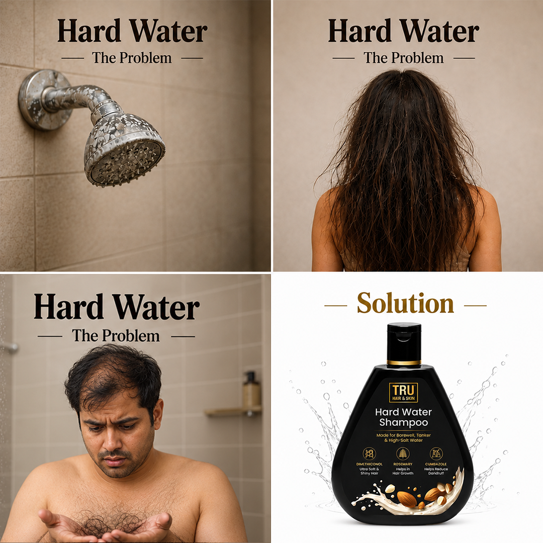 Hard Water Shampoo | For Ultra Soft , Shiny and Dandruff Free Hair