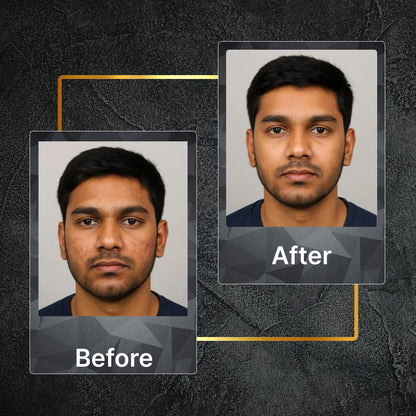 Acne Combo - Alpha Glow SPF 50- 25ml + Night cream- 50gm + Nanotech Face Wash- 50ml