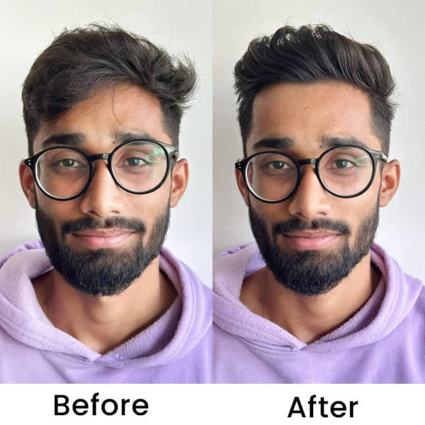Beardo Onion Oil - Concentrate Oil For Hair Growth – Beardo India
